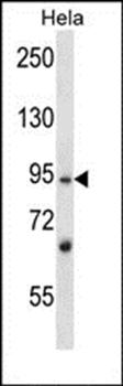 L3MBTL2 antibody