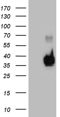 L3MBTL3 antibody