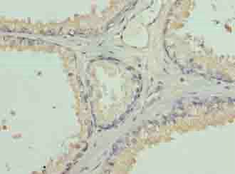 L3MBTL4 Antibody