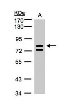 L3MBTL antibody