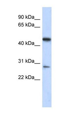 LACC1 antibody