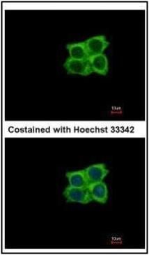 Ladinin 1 antibody