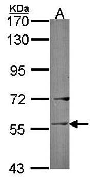 Ladinin 1 antibody