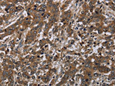 LAIR2 Antibody