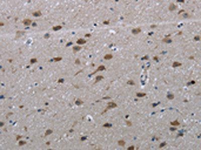 LAIR2 Antibody