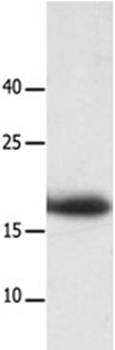 LAIR2 Antibody