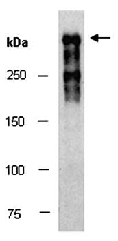 LAMA1 antibody