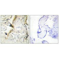 LAMA2 Antibody