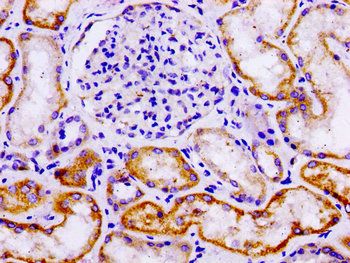 LAMA3 Antibody