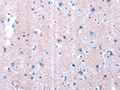LAMA3 Antibody