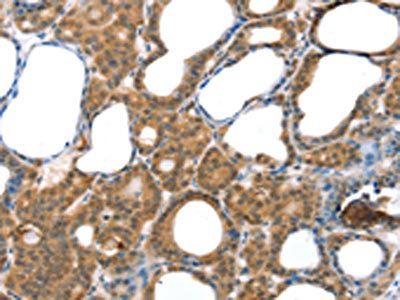 LAMA4 Antibody