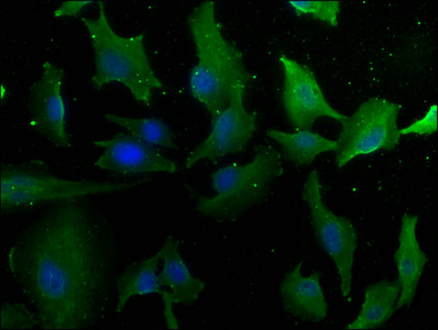 LAMA4 Antibody