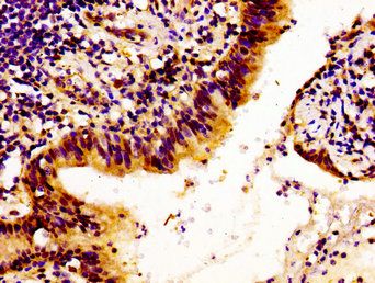 LAMB1 Antibody