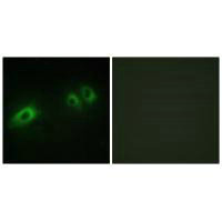 LAMB1 Antibody