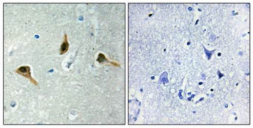 MSH2 Antibody