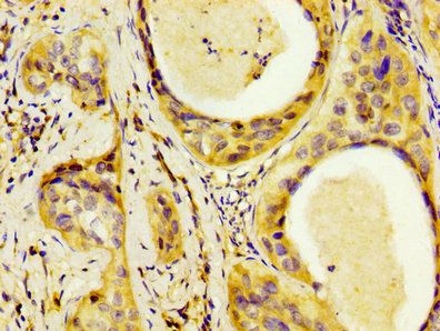 LAMB3 Antibody