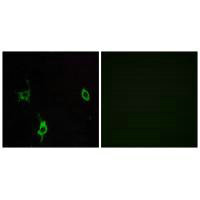 LAMC3 antibody