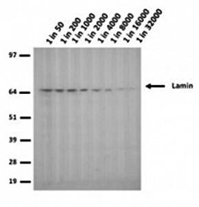 Lamin A/C R453W antibody
