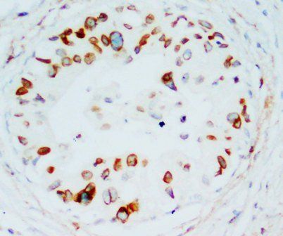 Anti-Lamin B1/LMNB1 Antibody