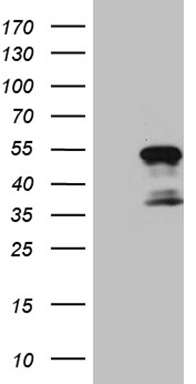 Laminin beta 2 (LAMB2) antibody