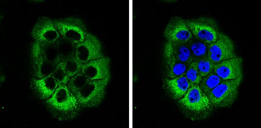 Laminin beta 3 Rabbit Polyclonal Antibody