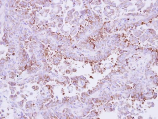 Laminin beta 3 Rabbit Polyclonal Antibody