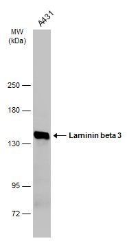 Laminin beta 3 Rabbit Polyclonal Antibody