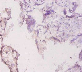 LAMC1 Antibody