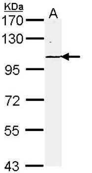 Laminin gamma-2 antibody