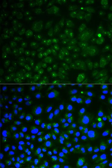 LAMP1 Antibody