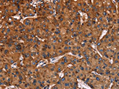 LAMP2 Antibody