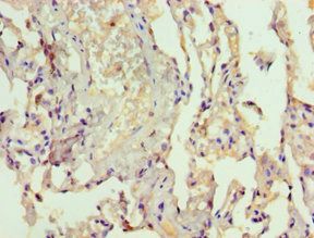 LAMTOR3 Antibody