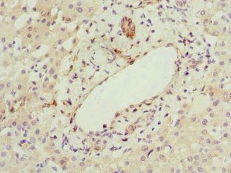 LAMTOR5 Antibody