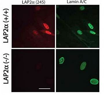 LAP2 alpha antibody