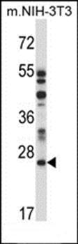 LAPTM4A antibody