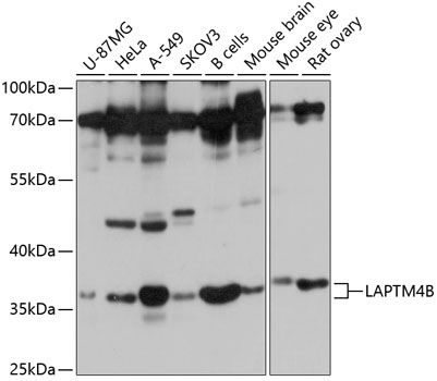 LAPTM4B antibody