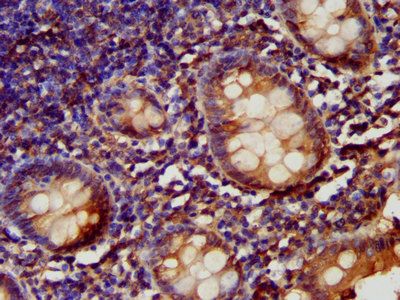 LARP6 Antibody