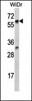 LARP7 antibody