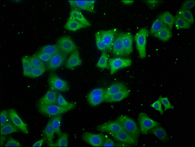LARS Antibody