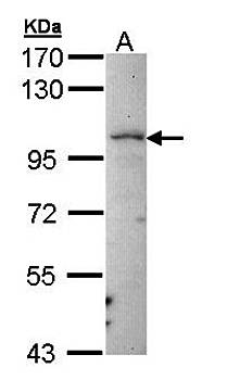 LARS2 antibody
