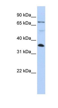 LASP1 antibody