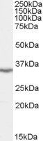 Goat anti-LASP1 (N Terminus) Antibody
