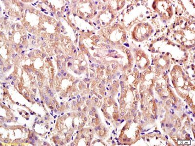 Ceramide synthase 2 Rabbit Polyclonal Antibody
