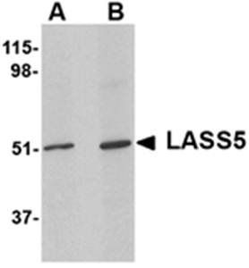 LASS5 Antibody
