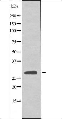 LAT (Phospho-Tyr161) antibody