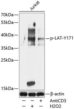 LAT (Phospho-Y171) antibody