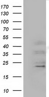 LAT2 (SLC7A8) antibody