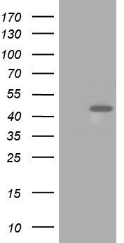 LAT2 (SLC7A8) antibody