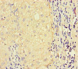 LATS1 Antibody