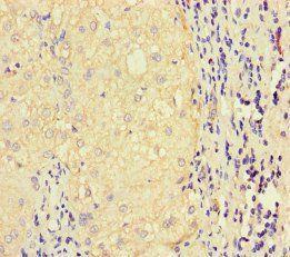 LATS1 antibody